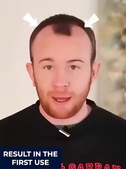 FEG PLUS Hair Growth Spray (IMPORTED)