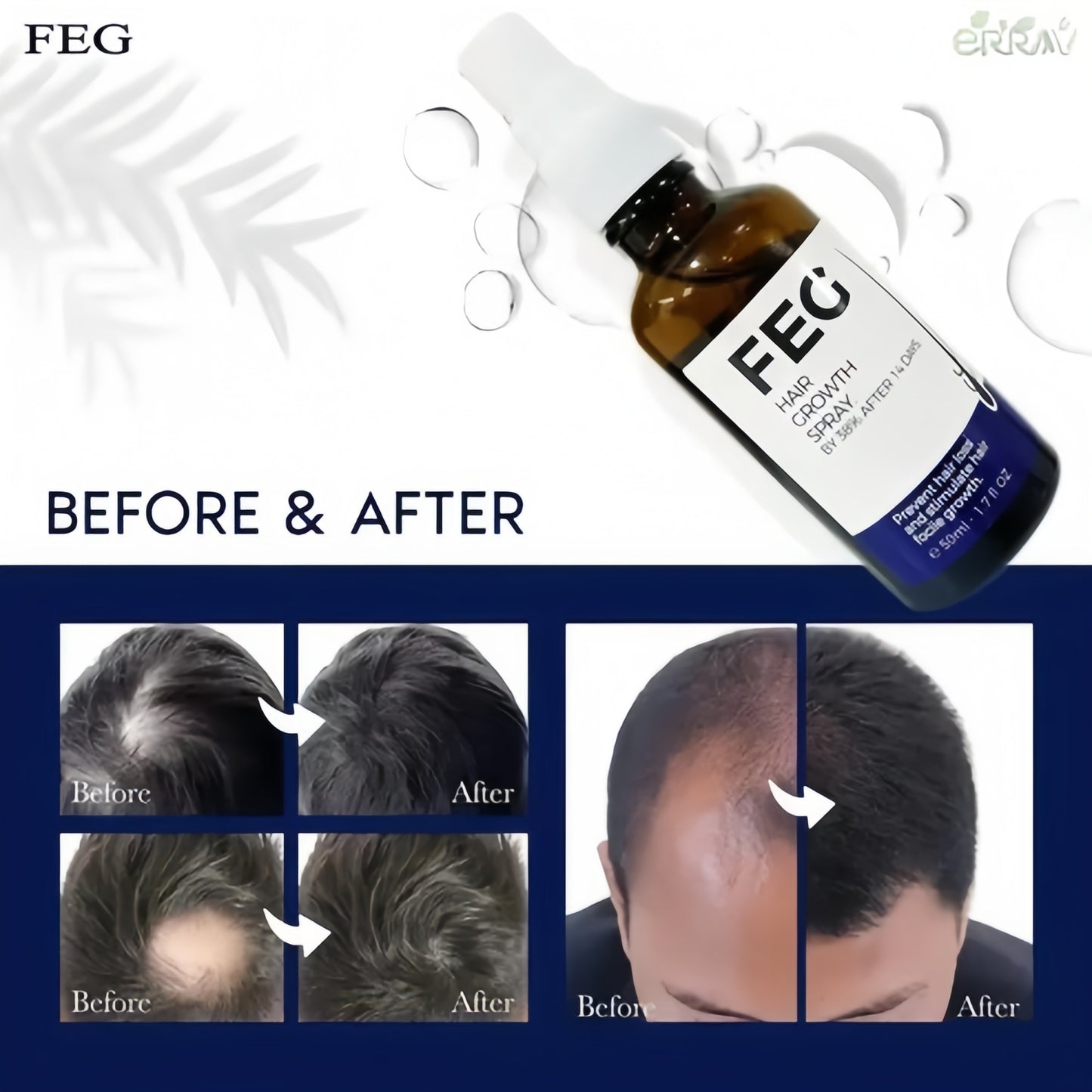 FEG PLUS Hair Growth Spray (IMPORTED)