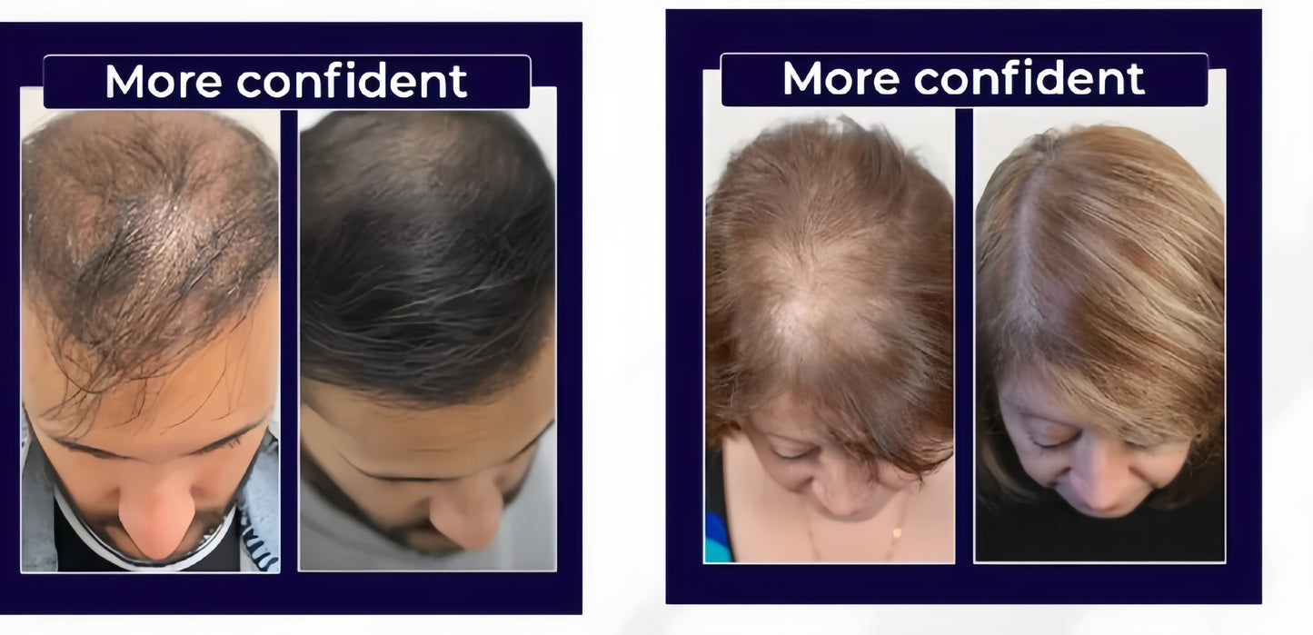 FEG PLUS Hair Growth Spray (IMPORTED)