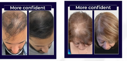 FEG PLUS Hair Growth Spray (IMPORTED)