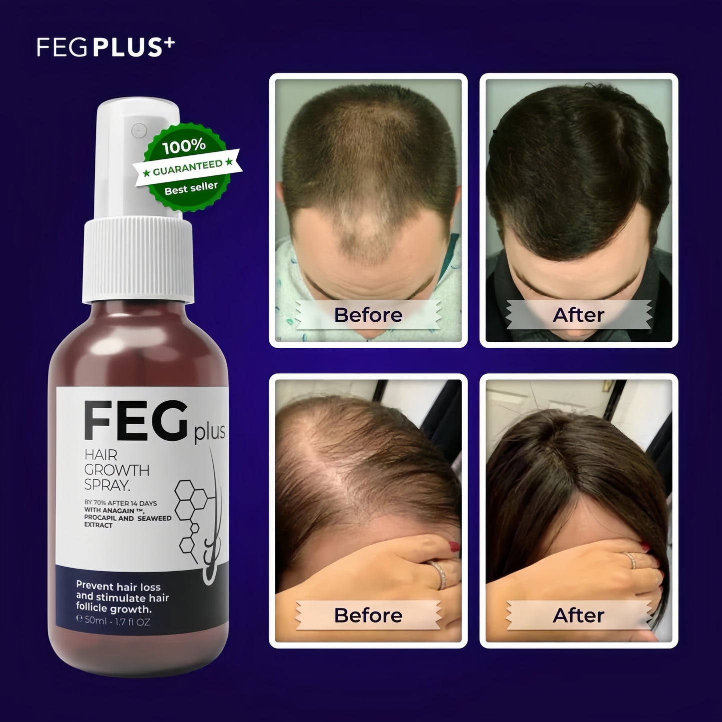 FEG PLUS Hair Growth Spray (IMPORTED)